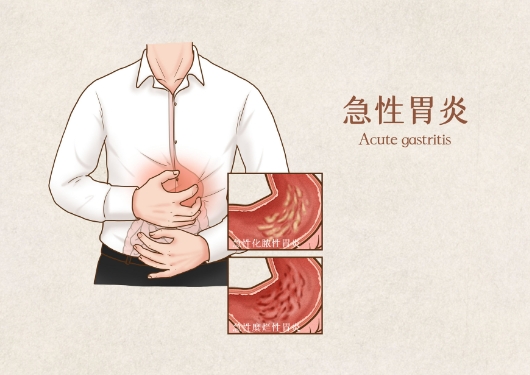 胃腸動力治療儀